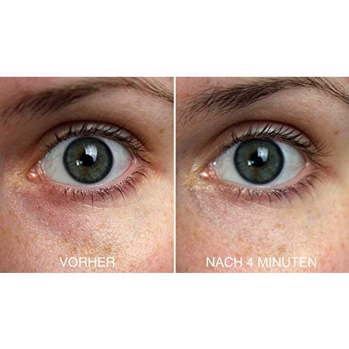 Augenserum Vitayes mit Anti-Aging Soforteffekt gegen Falten