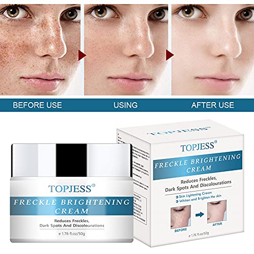 Whitening-Creme TOPJESS Freckle Brightening Cream