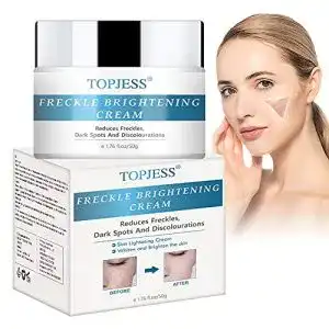 Whitening-Creme TOPJESS Freckle Brightening Cream