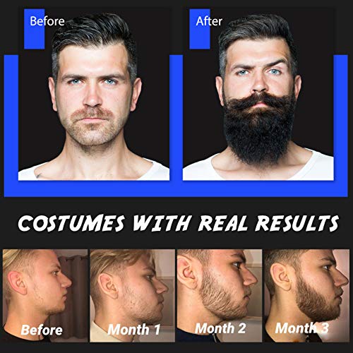 Bartwuchsmittel Scdom Beard Growth Kit, mit Bartroller