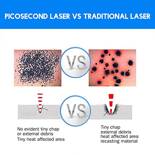 Muttermal-Entferner TMISHION Laser Pen Dot Mole Removal