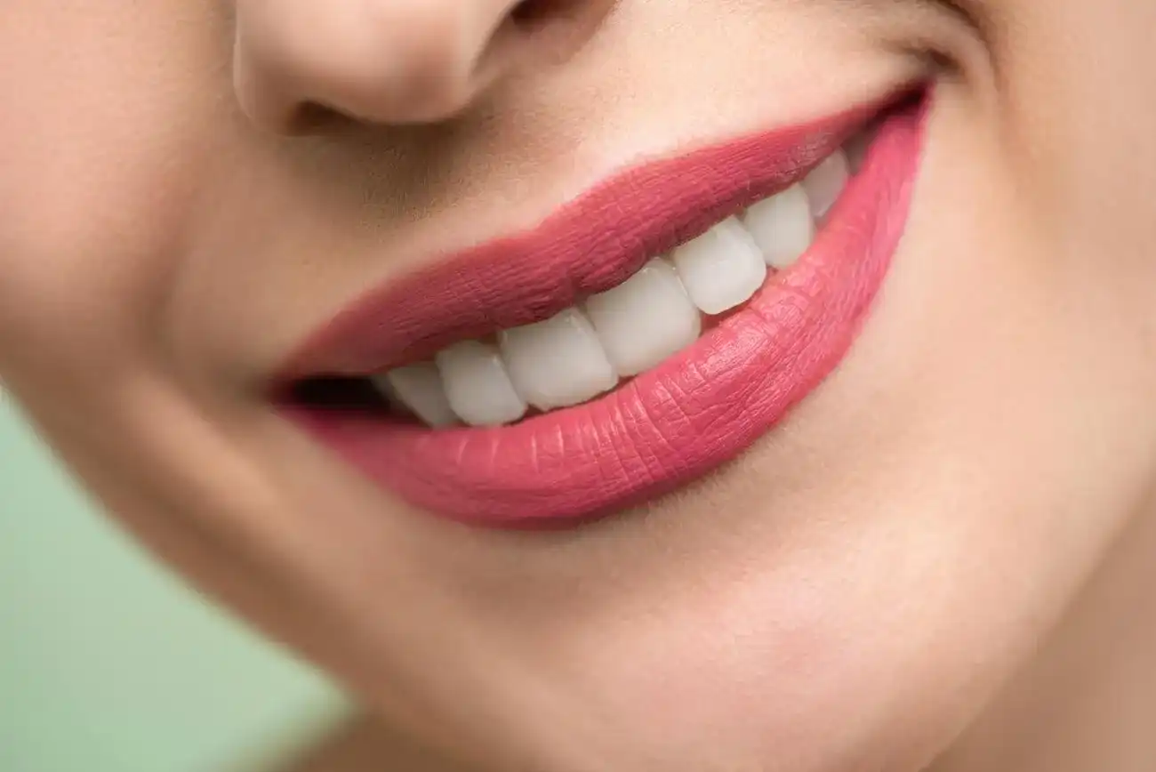 Bleaching-Gel