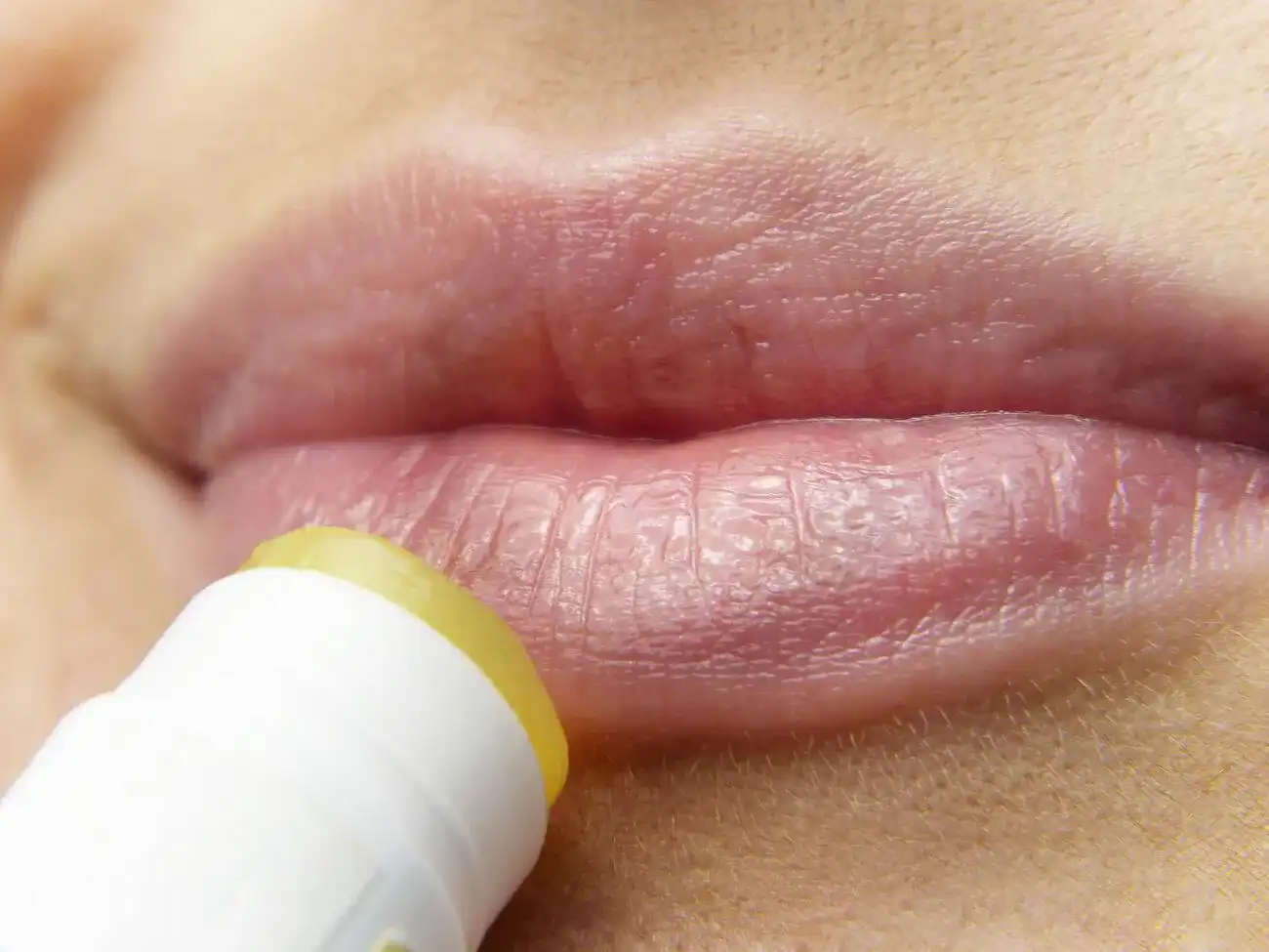 Lippenpflege Lippenpflege