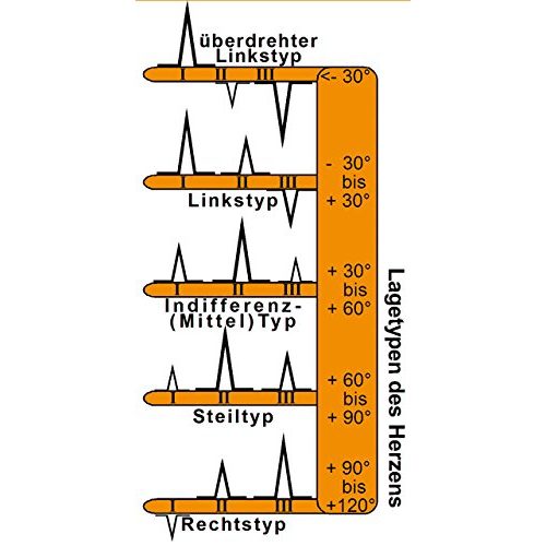 EKG-Lineal EKG Basic Set -professional- 3er Set EKG Lineal