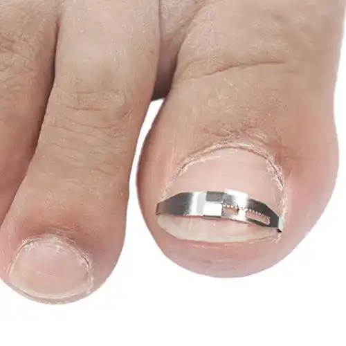 Nagelkorrekturspange