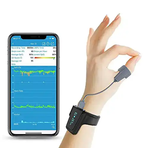 Pulsoximeter Bluetooth ViATOM Trendmedic CheckmeO2