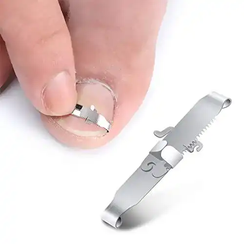 Nagelkorrekturspange BEZOX 2Pcs Zehennagel-Werkzeuge
