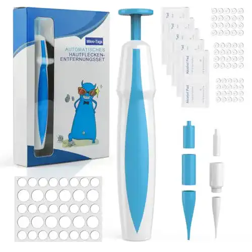 Stielwarzen-Entferner Kimmouzu Stielwarzen Entfernen Schnell Kit
