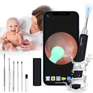 Ohrenschmalz-Entferner BlumWay WiFi Ohr Otoskop 3.5mm