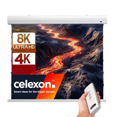 Kontrastleinwand celexon Home-Cinema Motor-Leinwand Tension Dynamic