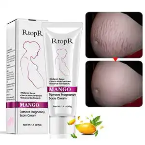 Dehnungsstreifen-Creme Duvina Stretch Marks Cream 40g